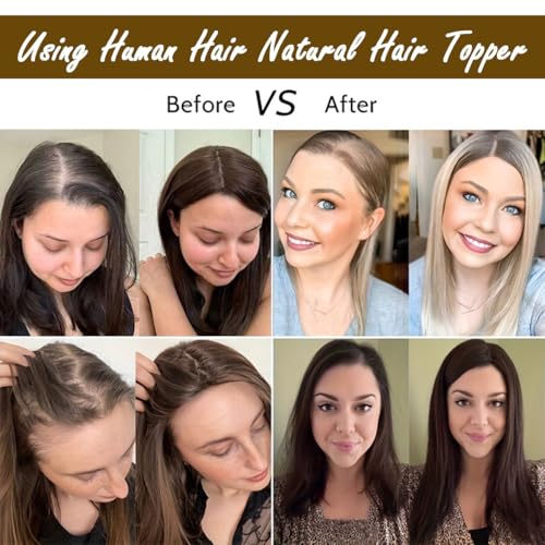 Hair Toppers For Women Real Human Hair Short Length Topper For Slightly Lossing And Covering Gray Hair 7 * 11 French Style Bang For Adding Volume