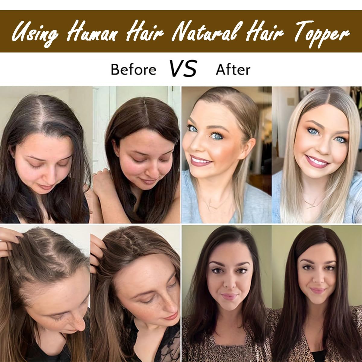 Hair Toppers For Women Synthetic Protein Fiber Curly Style Topper For Short Hair Length Women Solve Slightly Lossing And Gray Hair Problems